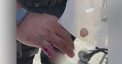 LAPD Officer Has Finger Bitten Off By Homeless Man Who Was Resisting Arrest | The Gateway Pundit | by Cassandra MacDonald